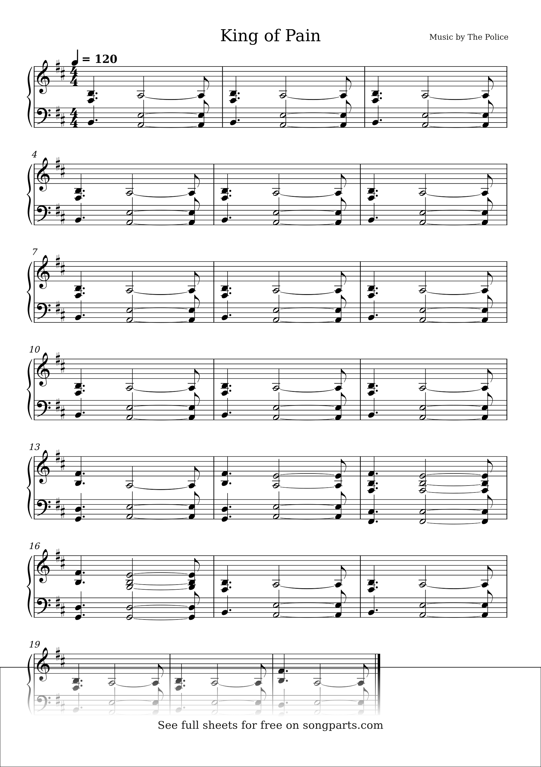 Sheet music preview for King of Pain by The Police